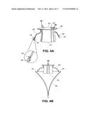 HEART VALVE PROSTHESIS WITH COLLAPSIBLE VALVE AND METHOD OF DELIVERY     THEREOF diagram and image