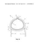 HEART VALVE PROSTHESIS WITH COLLAPSIBLE VALVE AND METHOD OF DELIVERY     THEREOF diagram and image