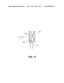 HEART VALVE PROSTHESIS WITH COLLAPSIBLE VALVE AND METHOD OF DELIVERY     THEREOF diagram and image