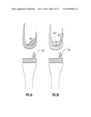 Posterior-Stabilized Knee Implant Components and Instruments diagram and image