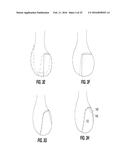 Posterior-Stabilized Knee Implant Components and Instruments diagram and image