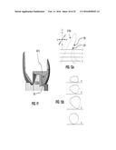 Posterior-Stabilized Knee Implant Components and Instruments diagram and image