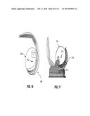 Posterior-Stabilized Knee Implant Components and Instruments diagram and image