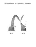 Posterior-Stabilized Knee Implant Components and Instruments diagram and image