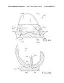 TIBIAL BEARING COMPONENT FOR A KNEE PROSTHESIS WITH IMPROVED ARTICULAR     CHARACTERISTICS diagram and image