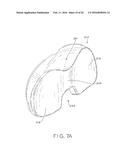 TIBIAL BEARING COMPONENT FOR A KNEE PROSTHESIS WITH IMPROVED ARTICULAR     CHARACTERISTICS diagram and image