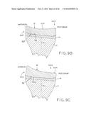 TIBIAL BEARING COMPONENT FOR A KNEE PROSTHESIS WITH IMPROVED ARTICULAR     CHARACTERISTICS diagram and image