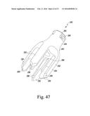 STEMLESS HUMERAL COMPONENT OF AN ORTHOPAEDIC SHOULDER PROSTHESIS diagram and image