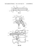 SURGICAL SYSTEM AND METHODS OF USE diagram and image