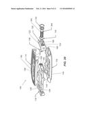 VARIABLE LORDOSIS SPACER AND RELATED METHODS OF USE diagram and image