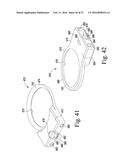 SIZING INSTRUMENT AND PUNCH FOR USE IN A SURGICAL PROCEDURE TO IMPLANT A     STEMLESS HUMERAL COMPONENT diagram and image