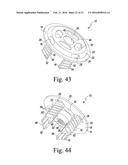 SIZING INSTRUMENT AND PUNCH FOR USE IN A SURGICAL PROCEDURE TO IMPLANT A     STEMLESS HUMERAL COMPONENT diagram and image