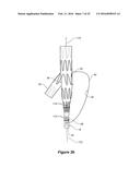 ENDOVASCULAR GRAFT HAVING A CANNULATION POCKET diagram and image