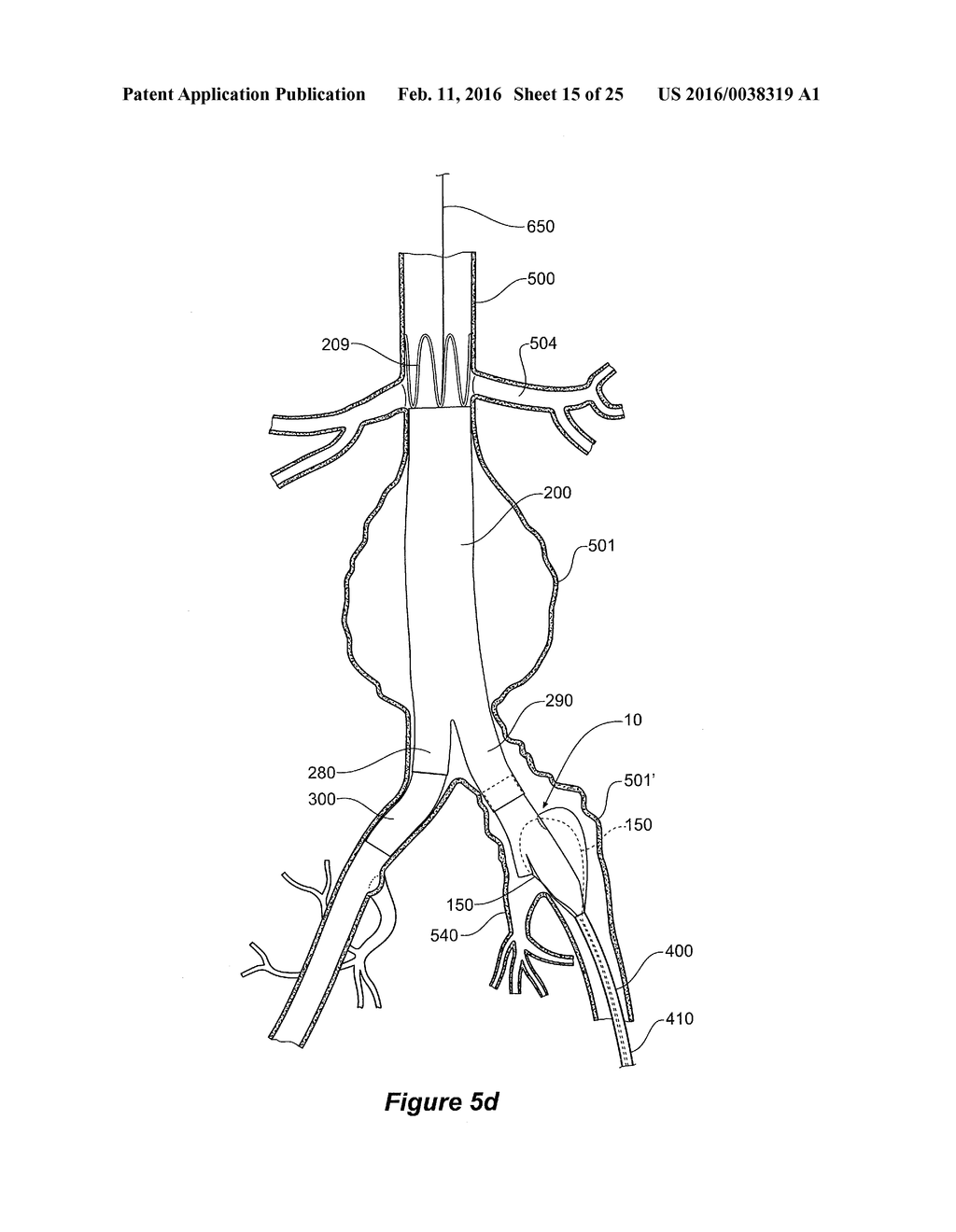 ENDOVASCULAR GRAFT HAVING A CANNULATION POCKET - diagram, schematic, and image 16