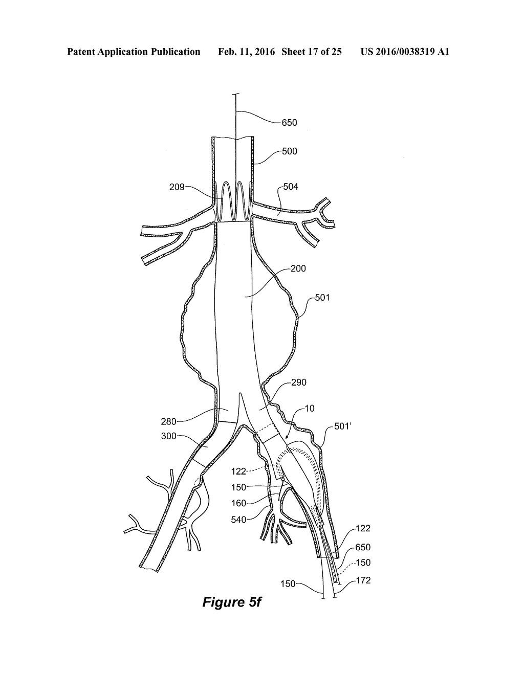 ENDOVASCULAR GRAFT HAVING A CANNULATION POCKET - diagram, schematic, and image 18