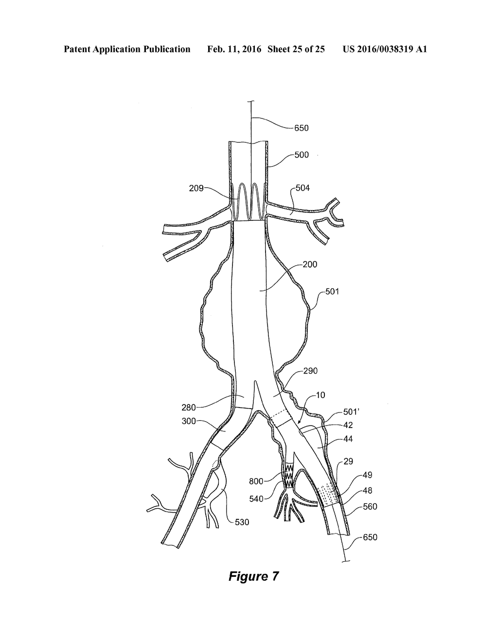 ENDOVASCULAR GRAFT HAVING A CANNULATION POCKET - diagram, schematic, and image 26
