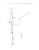 ADJUSTABLE IMPLANT AND METHOD OF USE diagram and image