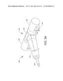 ADJUSTABLE IMPLANT AND METHOD OF USE diagram and image