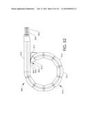 ADJUSTABLE IMPLANT AND METHOD OF USE diagram and image