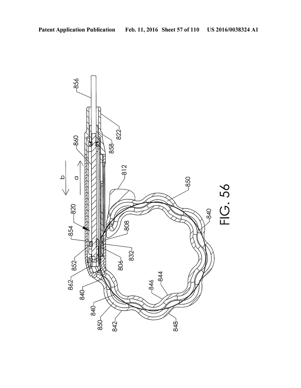 ADJUSTABLE IMPLANT AND METHOD OF USE - diagram, schematic, and image 58