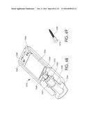 ADJUSTABLE IMPLANT AND METHOD OF USE diagram and image