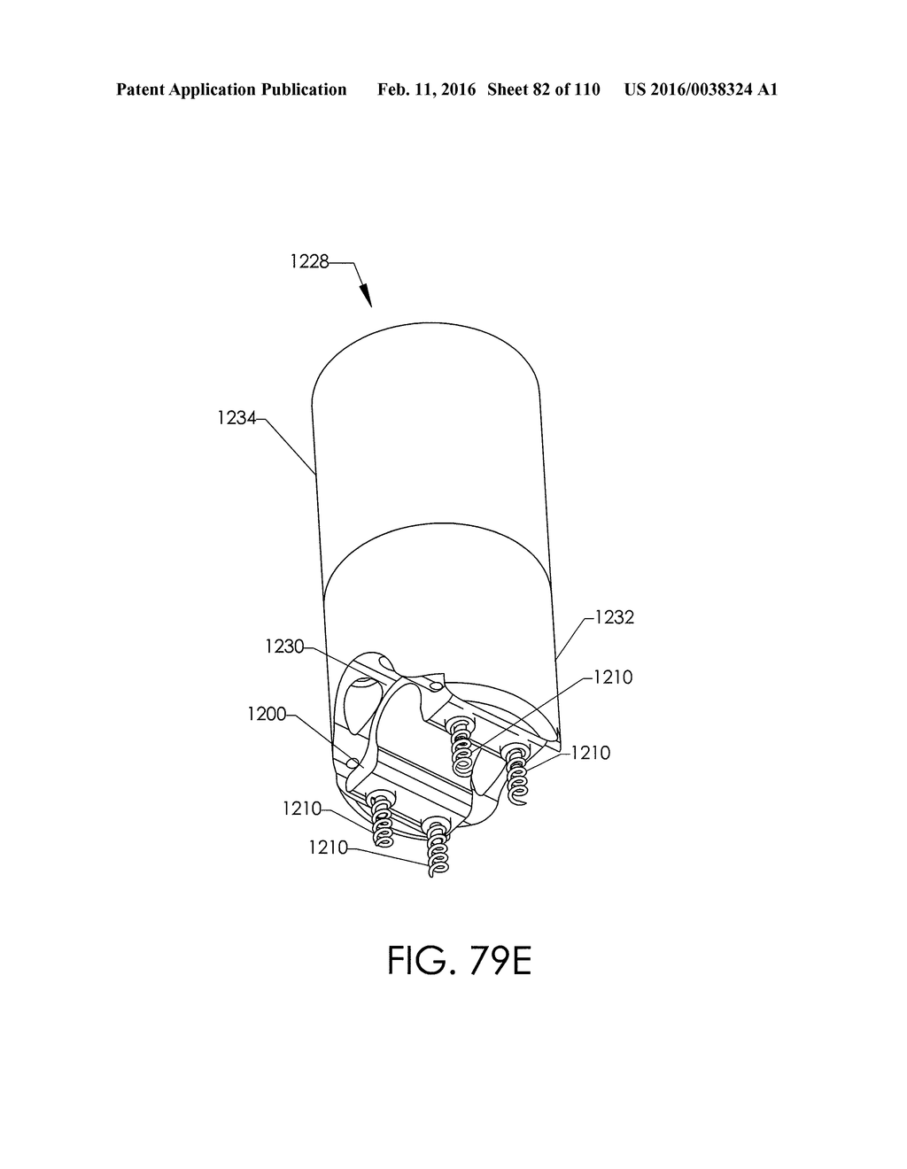 ADJUSTABLE IMPLANT AND METHOD OF USE - diagram, schematic, and image 83