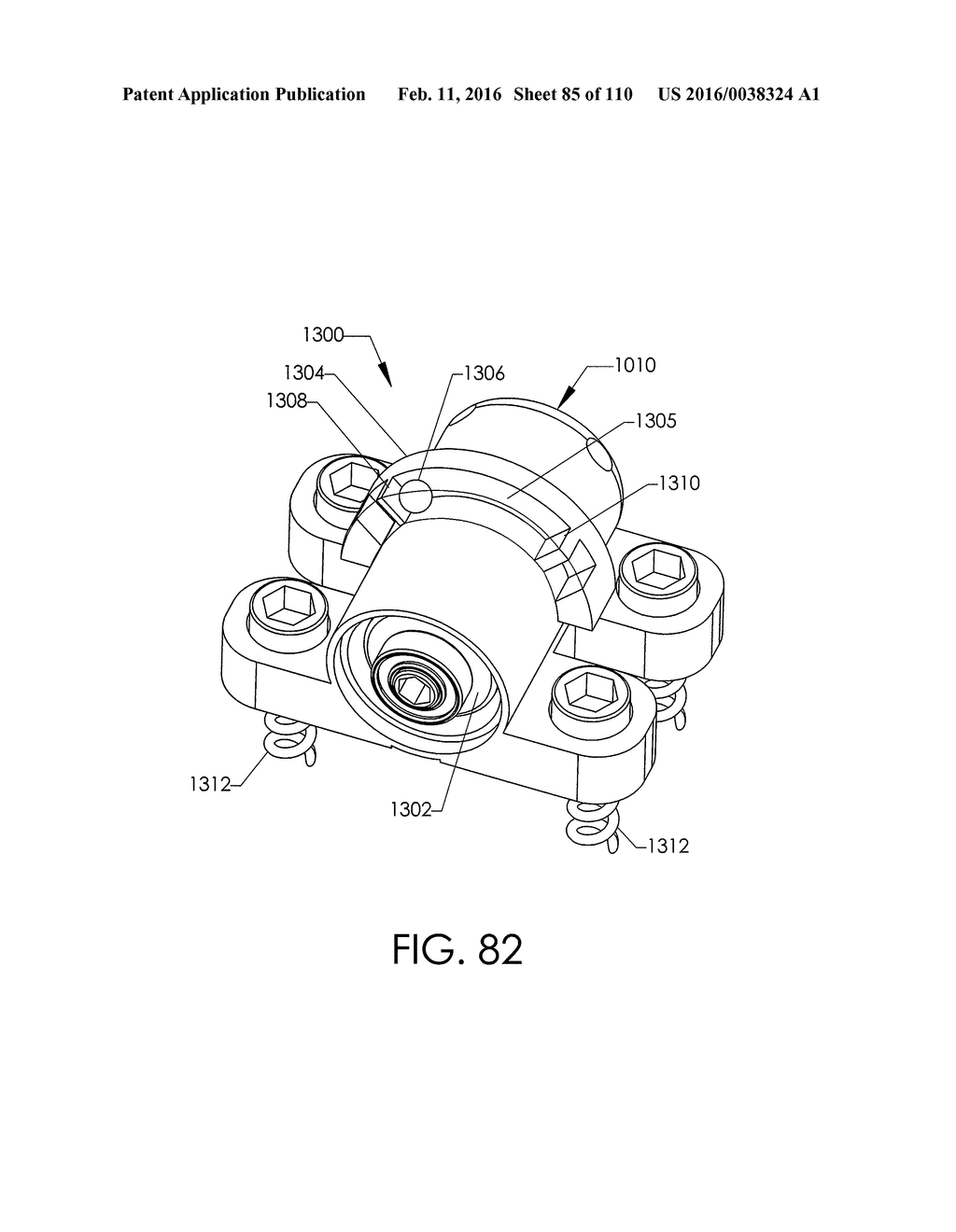 ADJUSTABLE IMPLANT AND METHOD OF USE - diagram, schematic, and image 86