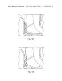 SELF-ACTIVATED LIFTING VEST WITH SENSORY-FEEDBACK AND METHODS OF USE     THEREOF diagram and image