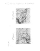 THE INHIBITION OF THE TOXIC EFFECTS OF ISLET AMYLOID FORMATION BY     FLURBIPROFEN AND FLURBIPROFEN DERIVATIVES diagram and image