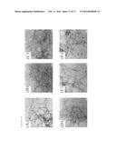 THE INHIBITION OF THE TOXIC EFFECTS OF ISLET AMYLOID FORMATION BY     FLURBIPROFEN AND FLURBIPROFEN DERIVATIVES diagram and image