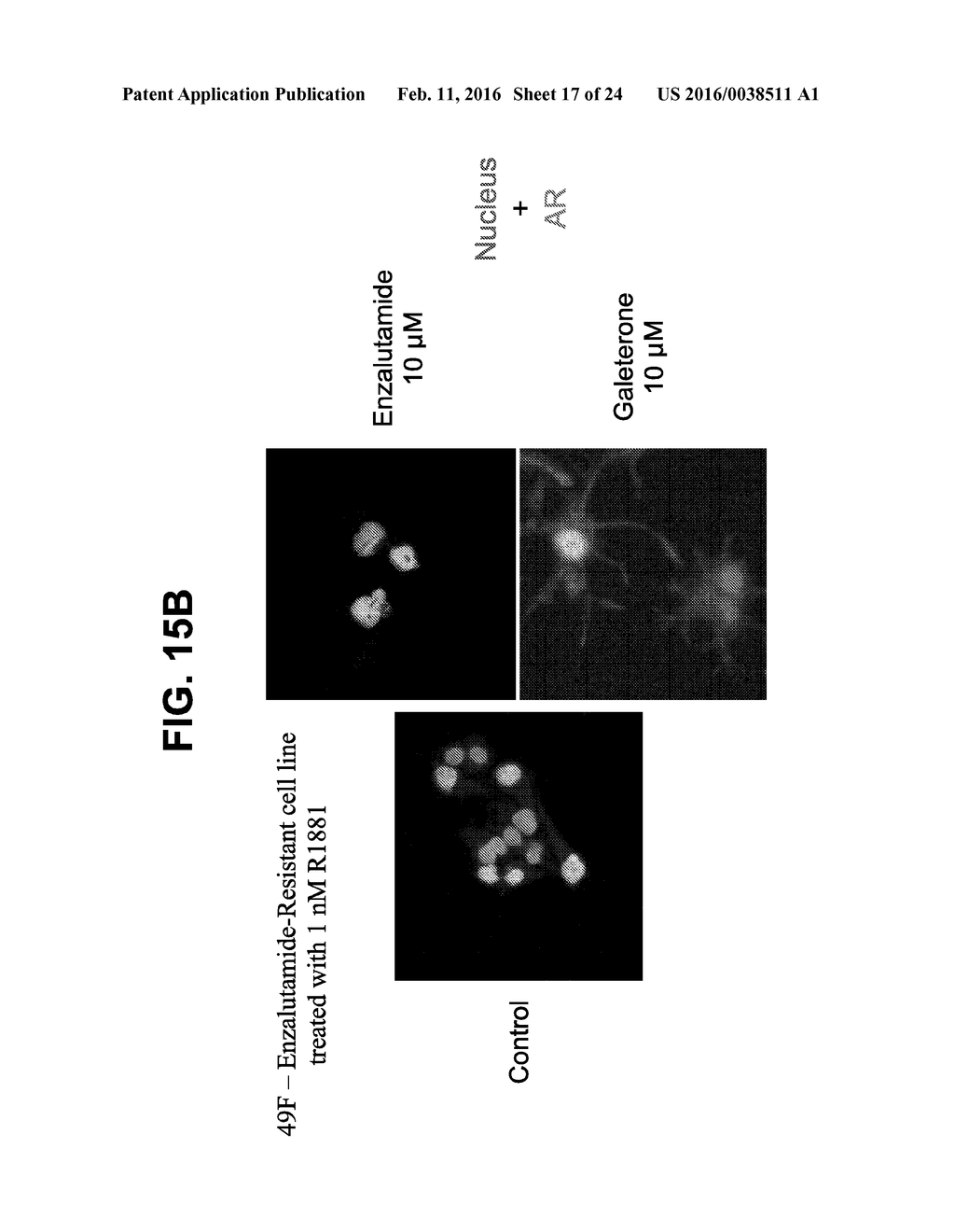 BIOMARKERS FOR TREATMENT OF NEOPLASTIC DISORDERS USING ANDROGEN-TARGETED     THERAPIES - diagram, schematic, and image 18