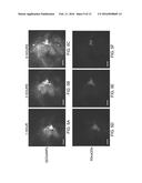 Multistage Nanoparticles diagram and image