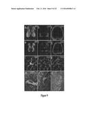 DELIVERY OF POLYNUCLEOTIDES USING RECOMBINANT AAV9 diagram and image