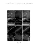 DELIVERY OF POLYNUCLEOTIDES USING RECOMBINANT AAV9 diagram and image