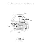 ORAL ANESTHESIA APPLICATION diagram and image