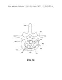 CARBOXYMETHYLCELLULOSE POLYETHYLENE GLYCOL COMPOSITIONS FOR MEDICAL USES diagram and image