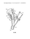 AIRWAY ADAPTERS AND SUCTION CATHETER SYSTEMS diagram and image