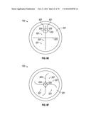 AIRWAY ADAPTERS AND SUCTION CATHETER SYSTEMS diagram and image