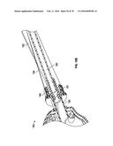 AIRWAY ADAPTERS AND SUCTION CATHETER SYSTEMS diagram and image