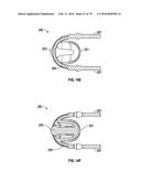 AIRWAY ADAPTERS AND SUCTION CATHETER SYSTEMS diagram and image