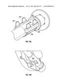 AIRWAY ADAPTERS AND SUCTION CATHETER SYSTEMS diagram and image