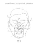 OXYGEN FACE MASK AND COMPONENT SYSTEM diagram and image