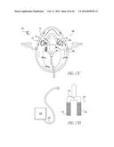 OXYGEN FACE MASK AND COMPONENT SYSTEM diagram and image