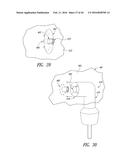 OXYGEN FACE MASK AND COMPONENT SYSTEM diagram and image