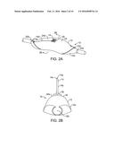 METHODS AND SYSTEMS FOR TREATING ISCHEMIC TISSUES diagram and image