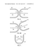 METHODS AND SYSTEMS FOR TREATING ISCHEMIC TISSUES diagram and image