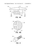 SHUNT FLUSHER diagram and image