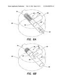 SHUNT FLUSHER diagram and image