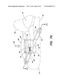 SHUNT FLUSHER diagram and image