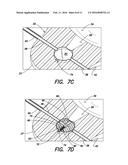 SHUNT FLUSHER diagram and image